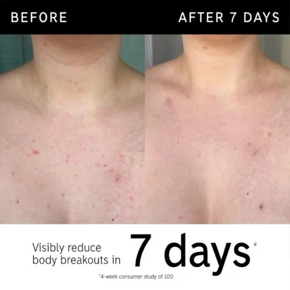 Glycolic Acid Body Stick